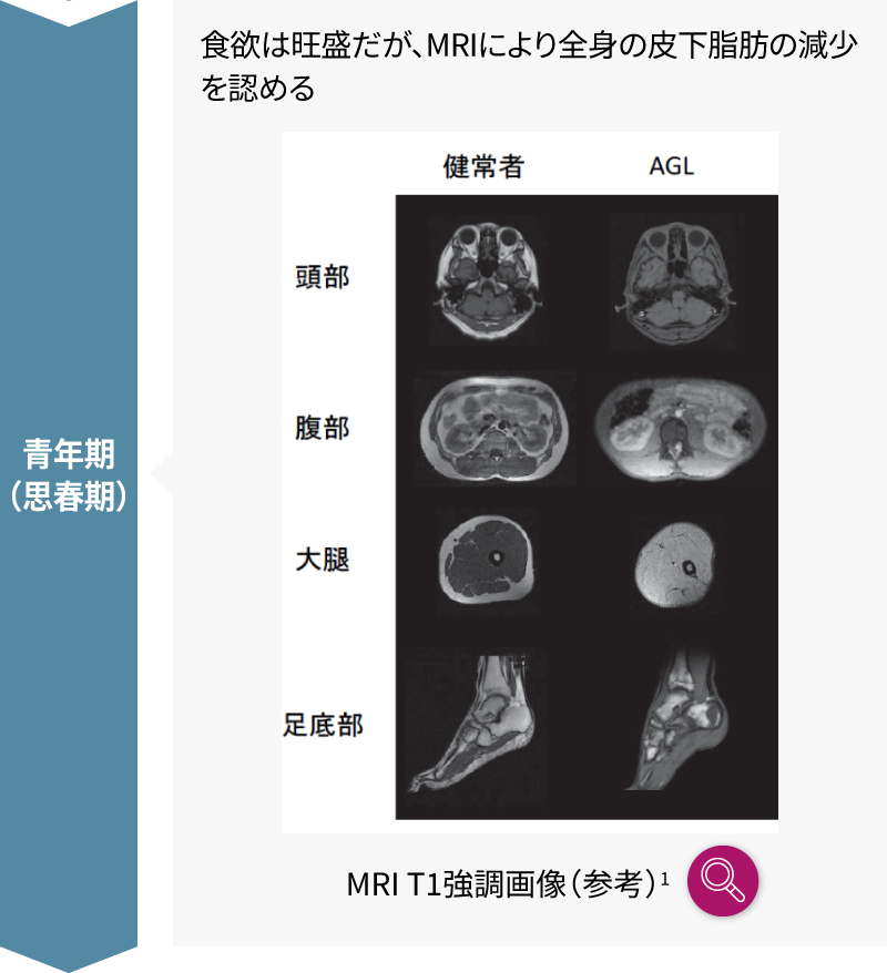 自己免疫性疾患を合併した男性患者